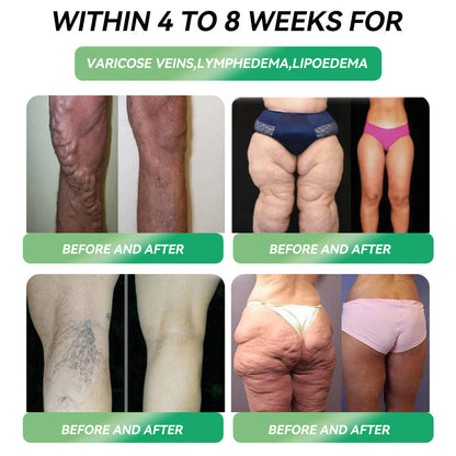 | 𝐋𝐚𝐬𝐭 𝐃𝐚𝐲 𝐏𝐫𝐨𝐦𝐨𝐭𝐢𝐨𝐧 𝟖𝟎% 𝐎𝐅𝐅 | 🇬🇧𝐏𝐄𝐀𝐊𝐀® 𝐆𝐋𝐏-𝟏 𝐒𝐈𝐗-𝐈𝐍-𝐎𝐍𝐄 𝐇𝐞𝐚𝐥𝐭𝐡 𝐒𝐨𝐥𝐮𝐭𝐢𝐨𝐧 𝐎𝐫𝐚𝐥 𝐋𝐢𝐪𝐮𝐢𝐝  (𝐄𝐯𝐞𝐫𝐲 𝐨𝐭𝐡𝐞𝐫 𝐝𝐚𝐲, 𝐯𝐢𝐬𝐢𝐛𝐥𝐞 𝐜𝐡𝐚𝐧𝐠𝐞𝐬 𝐢𝐧 𝟕 𝐝𝐚𝐲𝐬） ✅ 𝐅𝐨𝐫 𝐨𝐛𝐞𝐬𝐢𝐭𝐲, 𝐜𝐚𝐫𝐝𝐢𝐨𝐯𝐚𝐬𝐜𝐮𝐥𝐚𝐫 𝐡𝐞𝐚𝐥𝐭𝐡, 𝐝𝐢𝐚𝐛𝐞𝐭𝐞𝐬, 𝐬𝐥𝐞𝐞𝐩 𝐚𝐩𝐧𝐞𝐚, 𝐆𝐮𝐭 𝐇𝐞𝐚𝐥𝐭𝐡, 𝐣𝐨𝐢𝐧𝐭 𝐢𝐬𝐬𝐮𝐞𝐬, 𝐚𝐧𝐝 𝐦𝐨𝐫𝐞